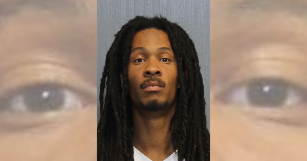 Man charged with assault after the mother of his child says he ripped out a chunk of her hair
